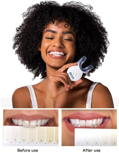 BEAM Whitening Kit